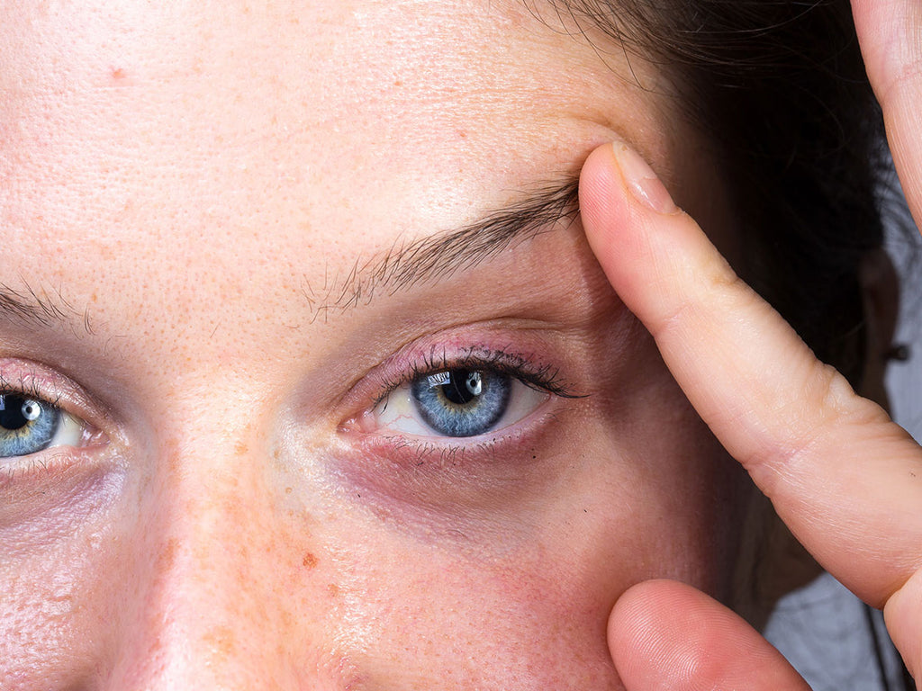 Non-Surgical Eye Lift - Alternative Treatments for Droopy Eyelids in 2023 - Contours Rx