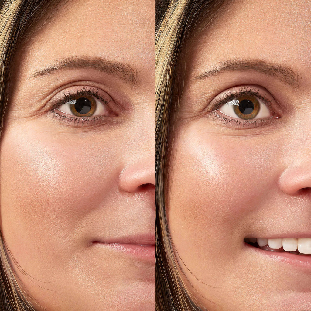 4 Droopy Eyelid Exercises for Bigger, More-Youthful Eyes