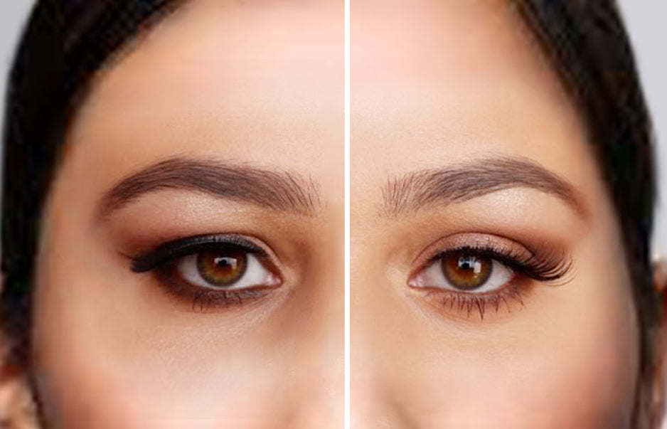 Drooping Eyelid Celebrities With Hooded Eyes