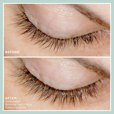 Lash Serum Before After
