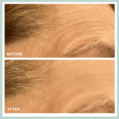 Lift It, Smooth It, Plump It