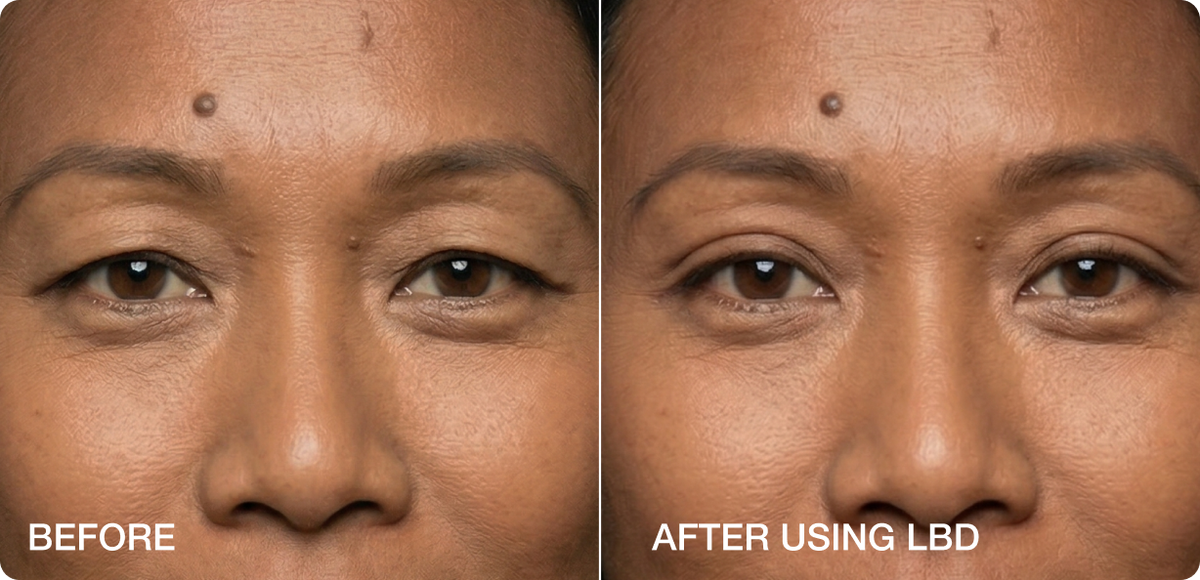 Mono Eyelids - How to place LIDS BY DESIGN on Mono eyelids?