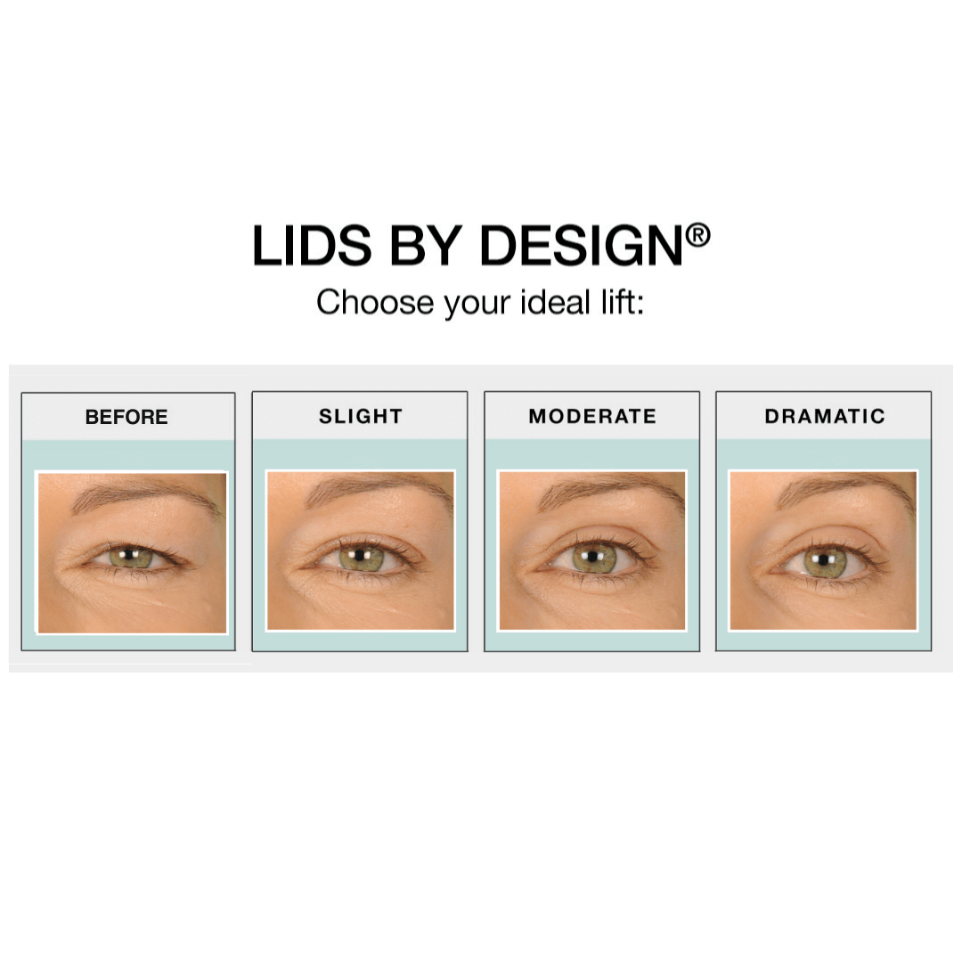 Lids By Design – Contours Rx