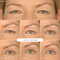 Lids By Design Cosmetic Eyelid Strips