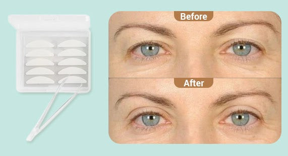 Contours Rx on X: Erasing the signs of aging with LIDS BY DESIGN  Correcting Strips! #beauty #eyeswideopen #hoodedeyelid #lidsbydesign   / X