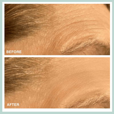 Microcrystal Patch | Reduce Eye Wrinkles | Contours Rx