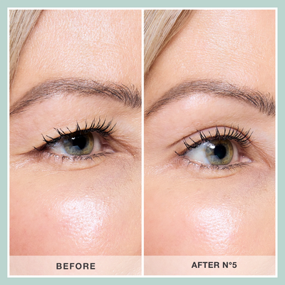 Explore Assortment Pack | Eyelid Lift Strips | Contours Rx
