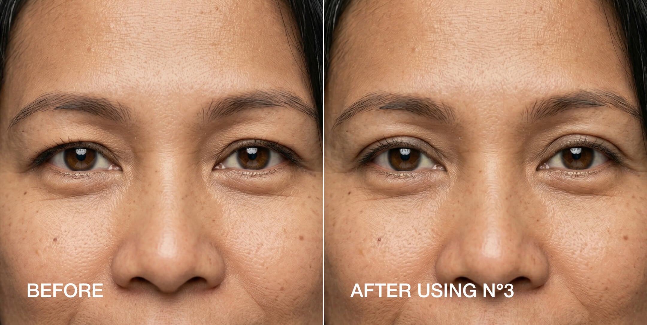 Eyelid tape before and after — Size 3 hooded eyes