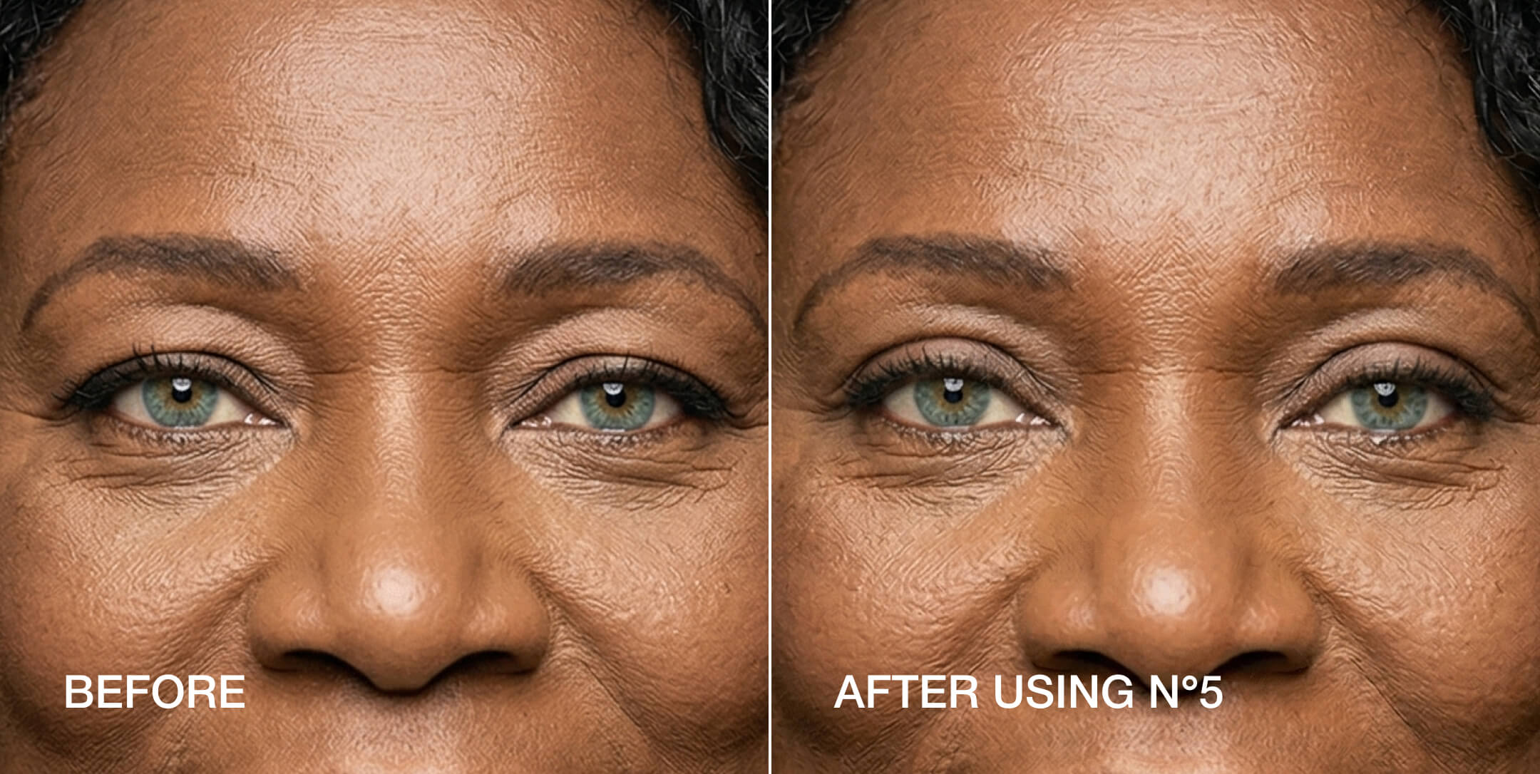 Instant eyelid lift before and after — Size 5 results