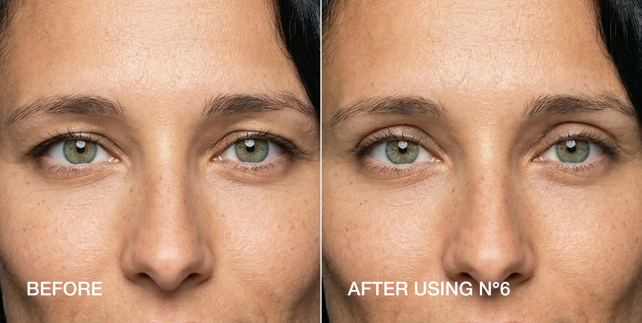Lids by Design before and after — Size 6 uneven eyelids