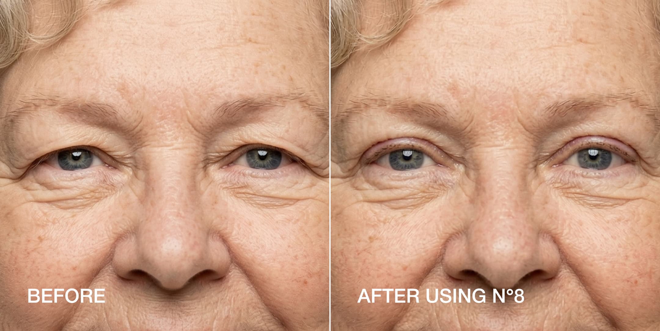 Hooded eyelid lift strips before and after — Size 8 results