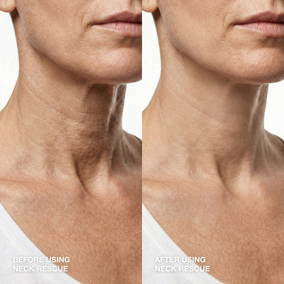 Instant Lift Set