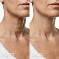 Instant Lift Set