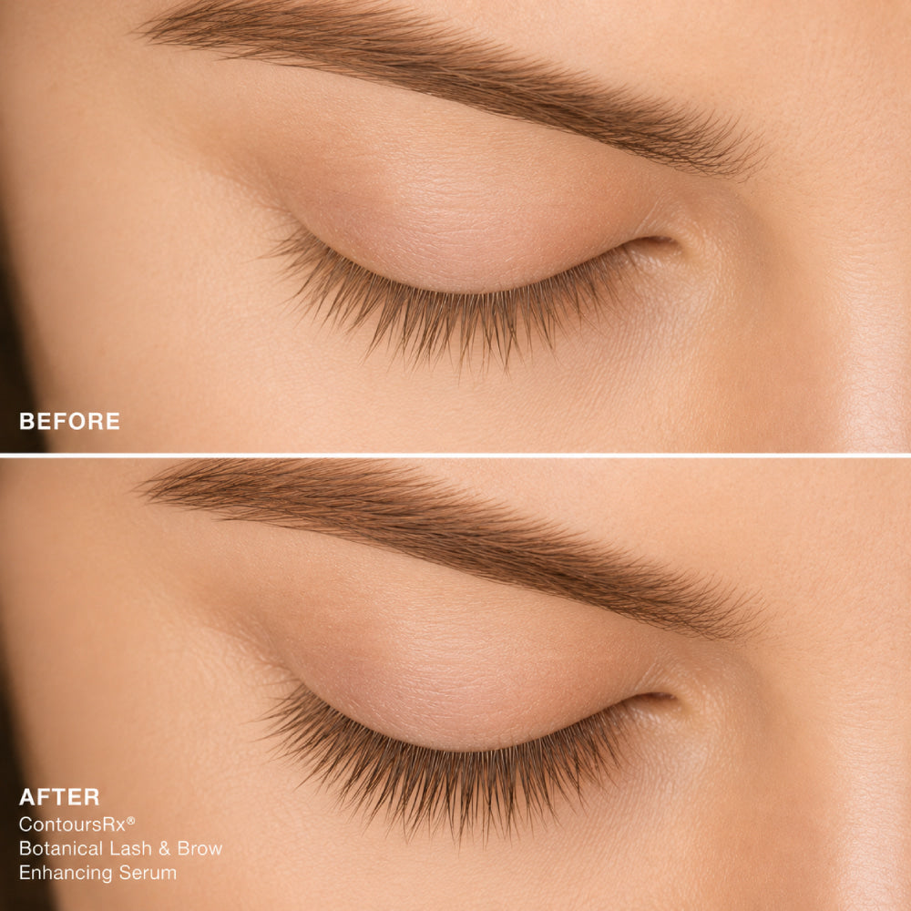 Eyelash serum before and after — Contours Rx UK