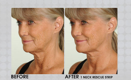 Contours RX Lids By Design Before and After 